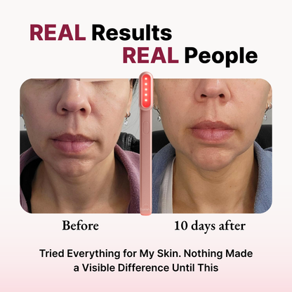 Lumeva - Deep Skin Skincare Wand