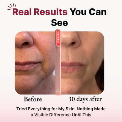 Lumeva - Deep Skin Skincare Wand