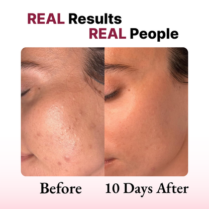 Lumeva - Pro Care Face Mask