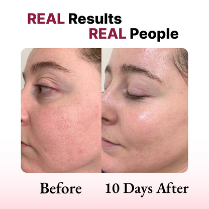 Lumeva - Pro Care Face Mask