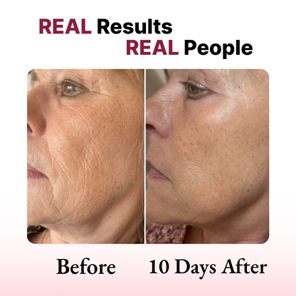 Lumeva - Pro Care Face Mask